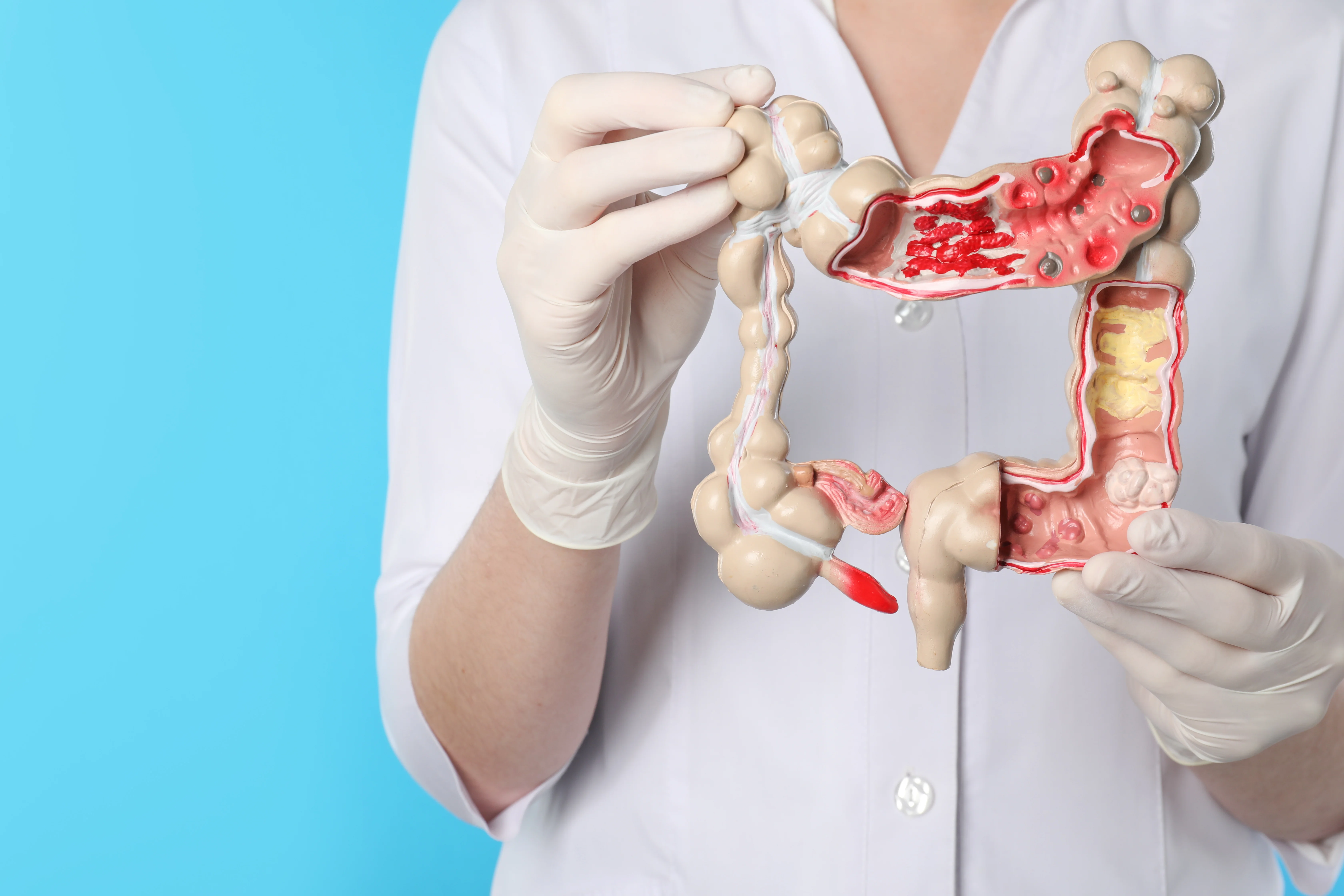 Gastroenterology and Hepatology department at Kapadia Multispeciality Hospital