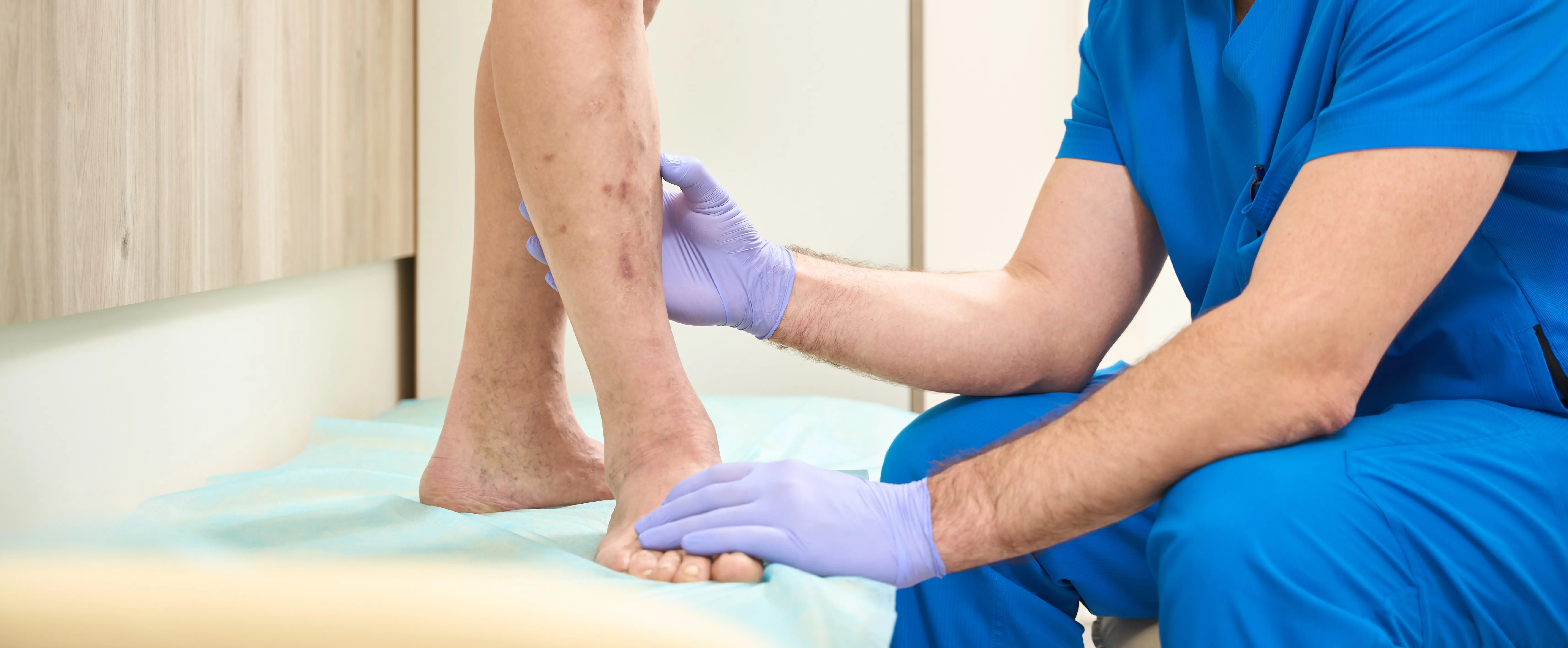 Laser Varicose Vein Treatment