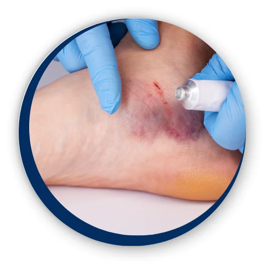 diabetic-1