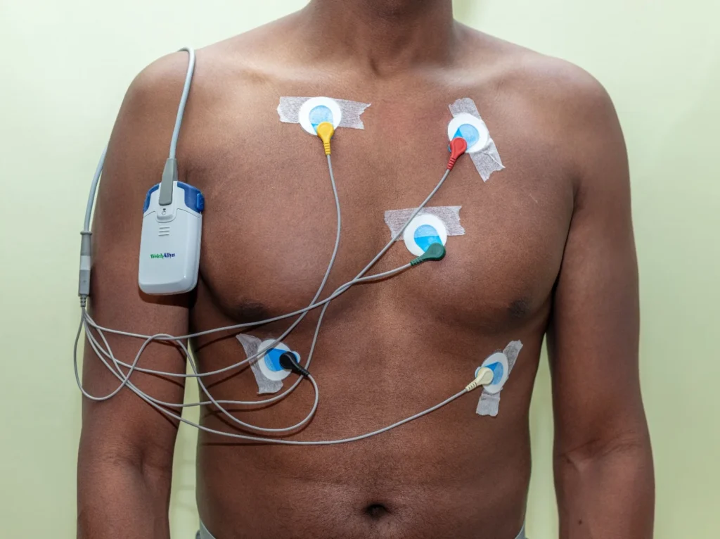 holter-3