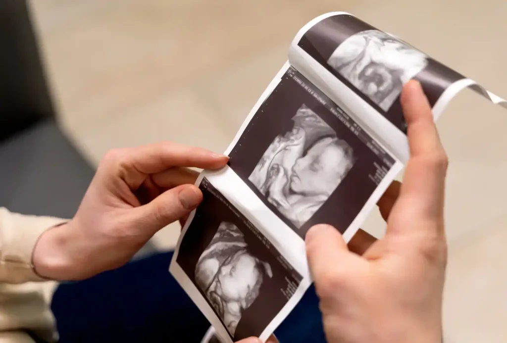 pregnancy1