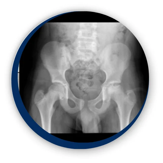 neuromuscular