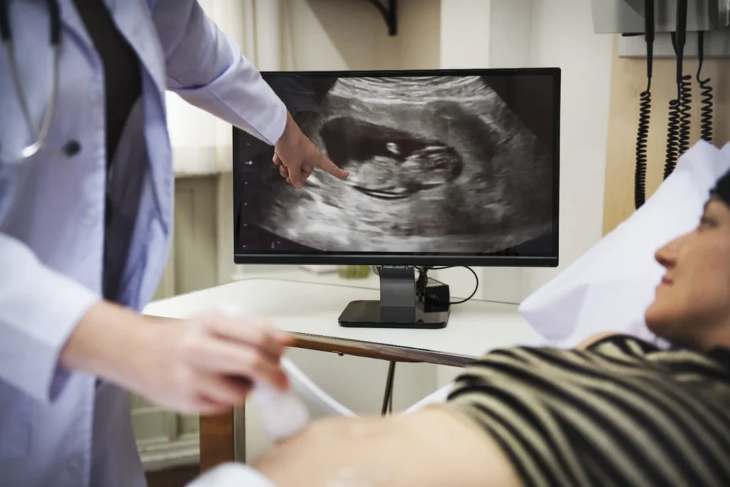 fetal-scan