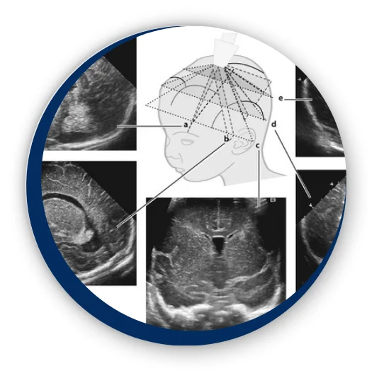 fetalneuro