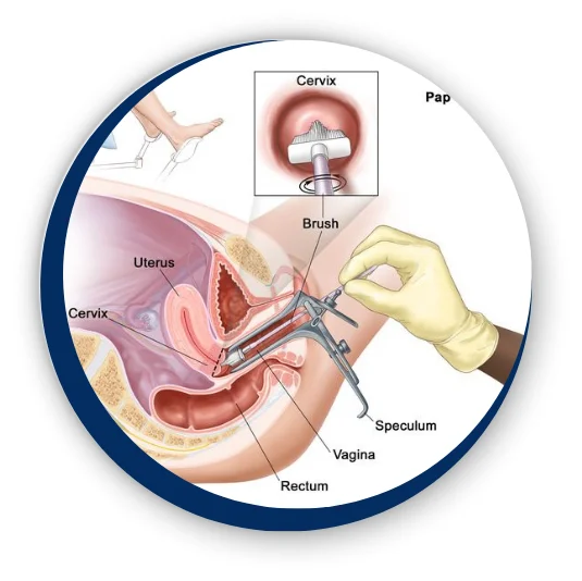 papsmear