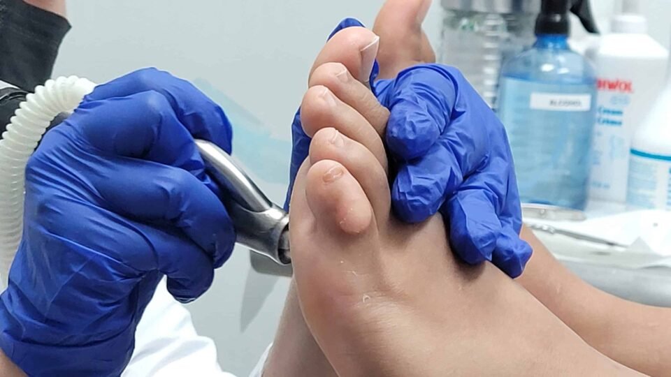Medical Pedicure
