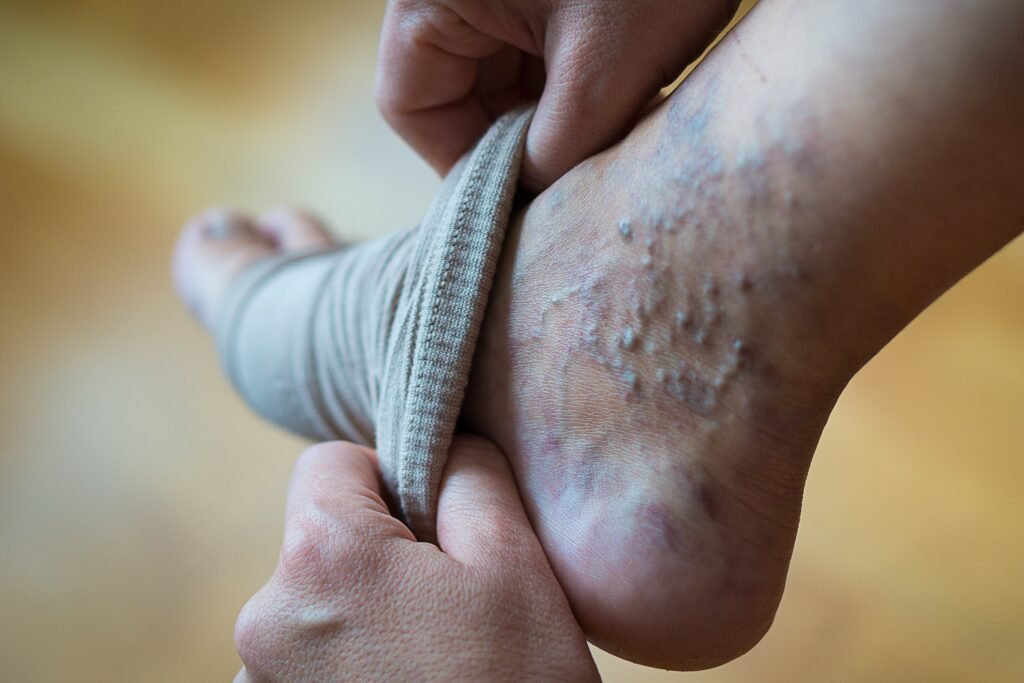 compression stockings for men in mumbai