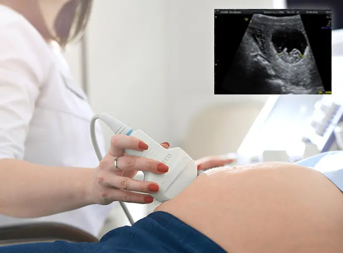 pregnancy scans